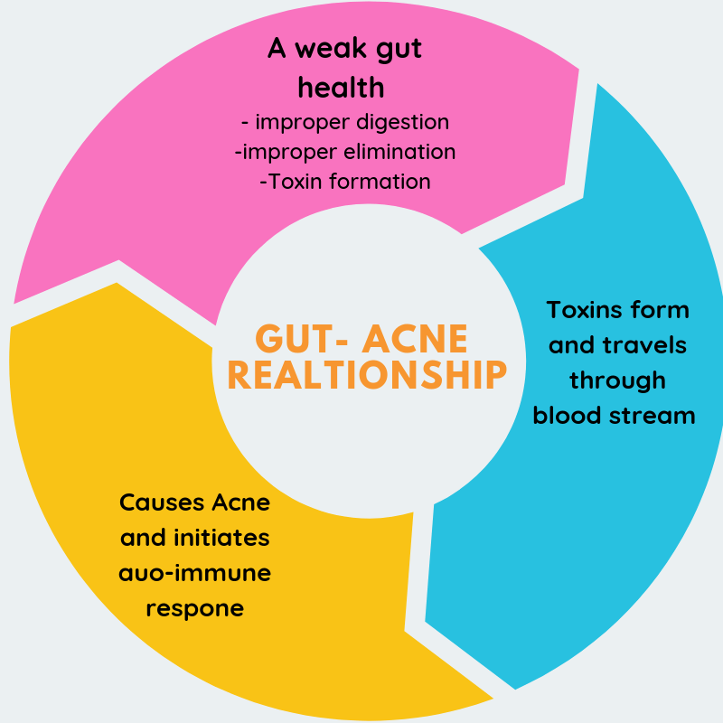 Gut health and acne An Ayurvedic guide for better skin and gut! BUDDHICA